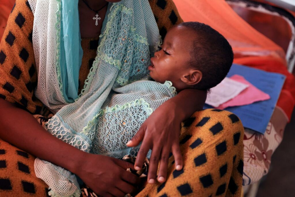 Niño desnutrido etíope en brazos de su madre