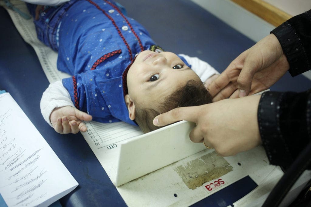 a toddler lies on an examination table.